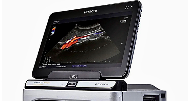 超音波画像観察