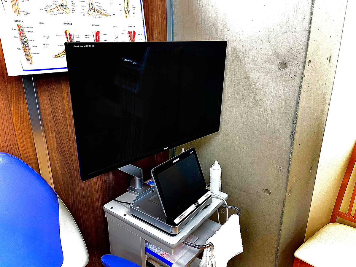 超音波画像診断装置