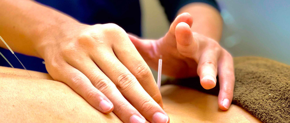 鍼灸